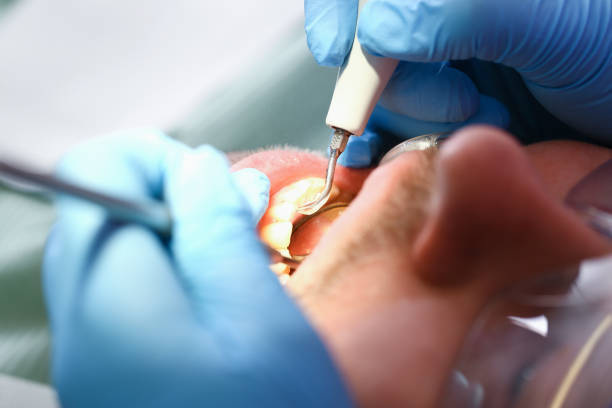 Best Emergency Dental Surgery in Zion, IL