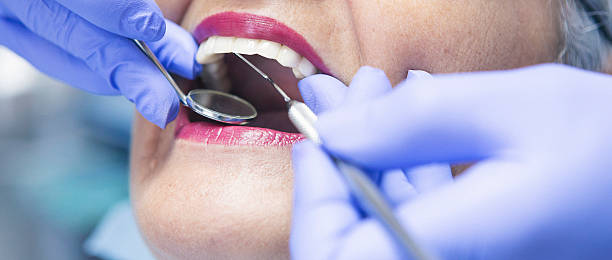 Best Emergency Broken Tooth Repair in Zion, IL